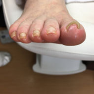 [爪切りの様子]